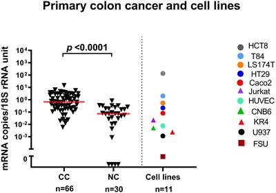 LGR6 is a prognostic biomarker for less differentiated tumors in lymph nodes of colon cancer patients